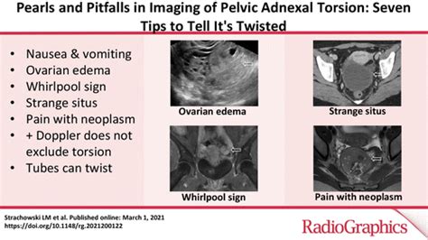 warning signs of ovarian torsion